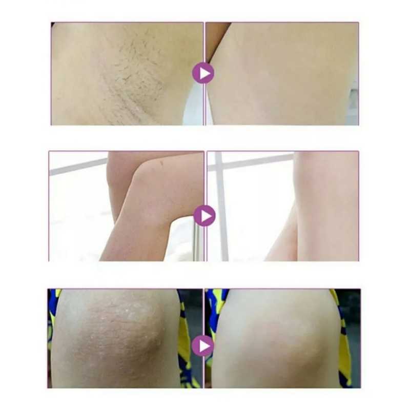 Crema aclaradora corporal